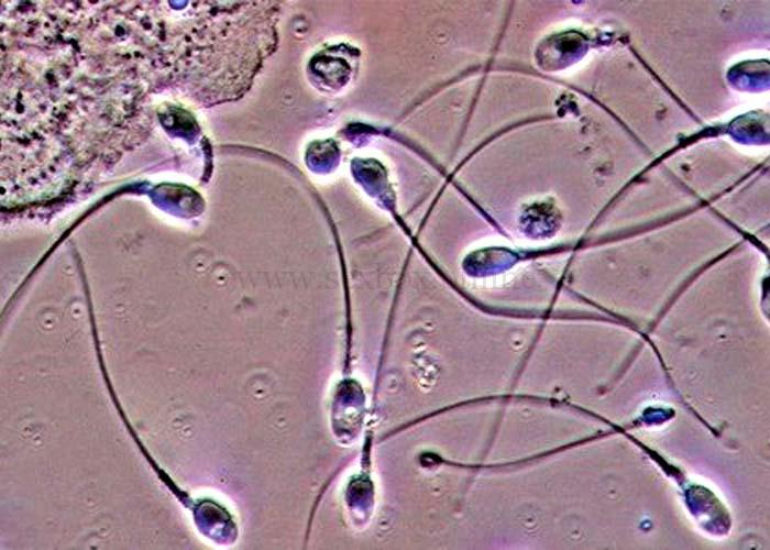 сперма под микроскопом